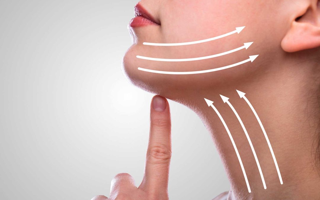 Fadenlifting – eine Hautstraffung ohne OP