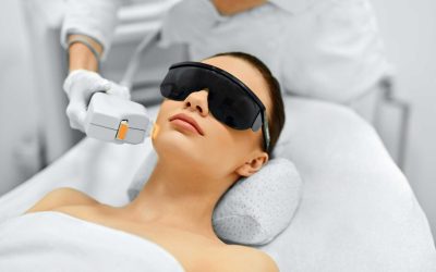 Couperose behandeln – lasern durch IPL Blitzlicht