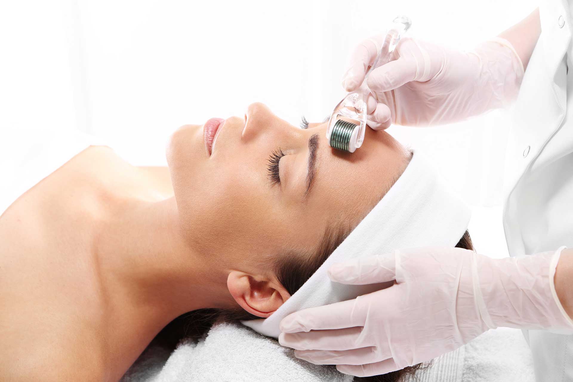 Microneedling