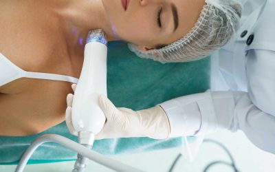 Radiofrequenz (RF) Microneedling für straffe Haut