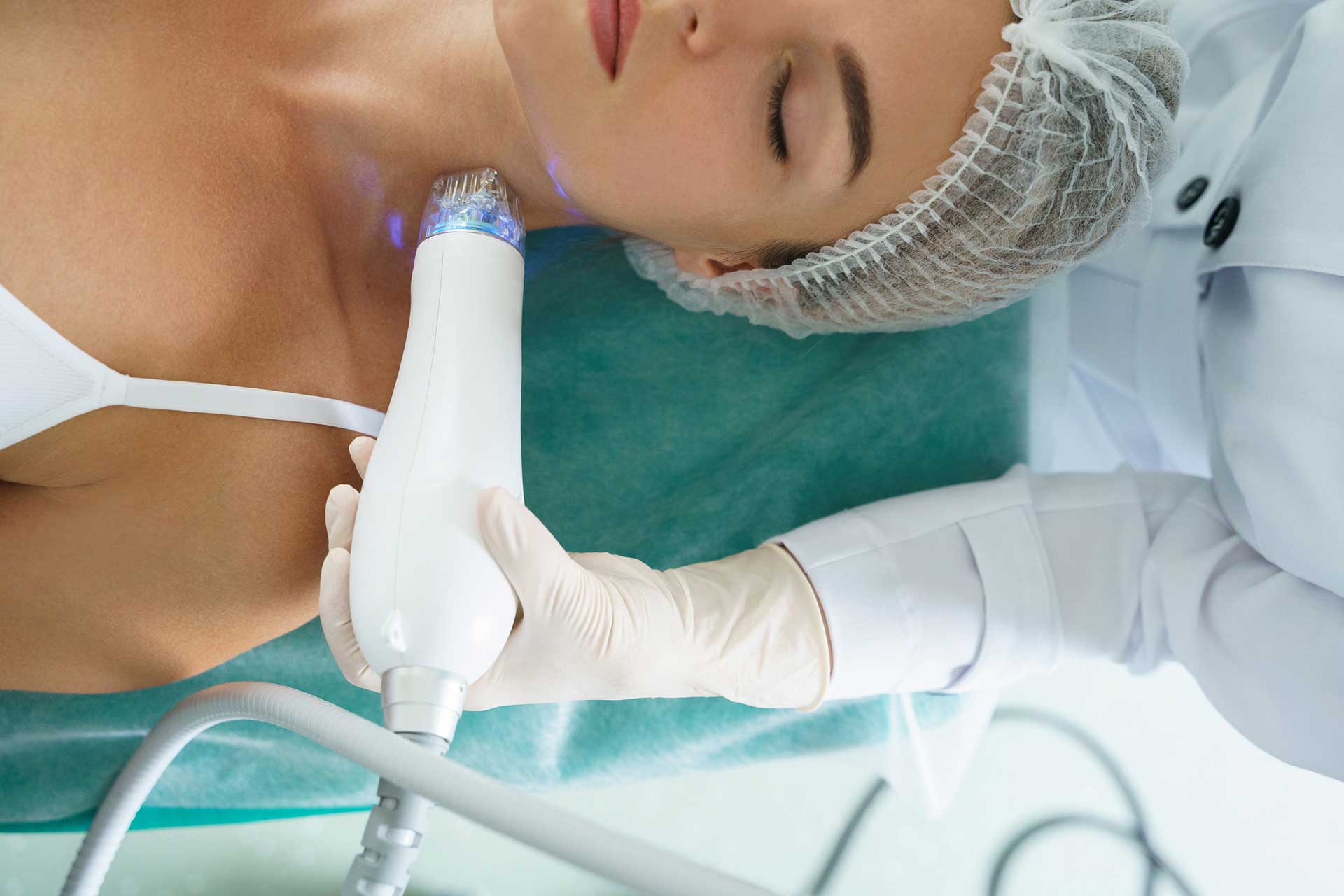 Microneedling und Radiofrequenz Microneedling Behandlung in Wien – regenerieren Sie Ihre Haut von innen heraus. RF Microneeling Microneedling Behandlungen in Wien